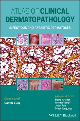 Atlas of Clinical Dermatopathology: Infectious and Parasitic Dermatoses by Burg