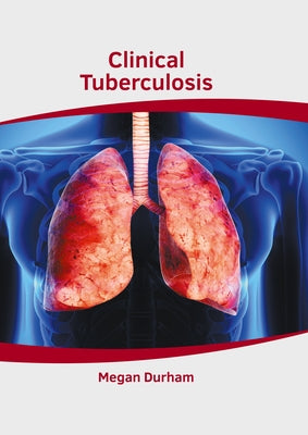 Clinical Tuberculosis by Durham, Megan