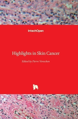 Highlights in Skin Cancer by Vereecken, Pierre