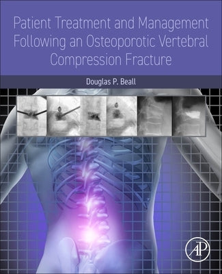 Patient Treatment and Management Following an Osteoporotic Vertebral Compression Fracture by Beall, Douglas P.