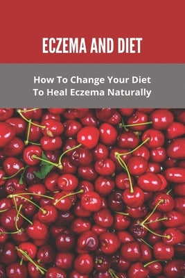 Eczema And Diet: How To Change Your Diet To Heal Eczema Naturally: How To Treat Eczema With Diet by Marguez, Wendell