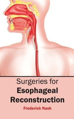 Surgeries for Esophageal Reconstruction by Nash, Frederick