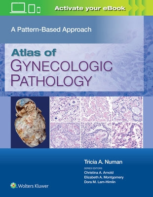 Atlas of Gynecologic Pathology: A Pattern-Based Approach by Numan, Tricia A.