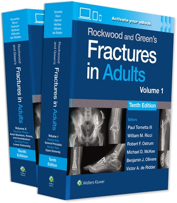 Rockwood and Green's Fractures in Adults: Print + eBook with Multimedia by Tornetta, Paul
