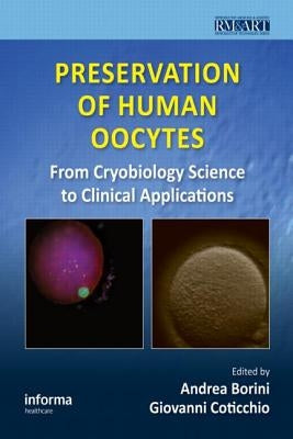 Preservation of Human Oocytes: From Cryobiology Science to Clinical Applications by Borini, Andrea