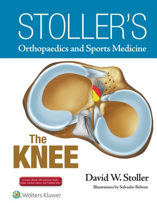 Stoller's Orthopaedics and Sports Medicine: The Knee: Includes Stoller Lecture Videos and Stoller Notes by Stoller, David W.