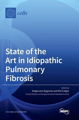 State of the Art in Idiopathic Pulmonary Fibrosis by Wygrecka, Malgorzata