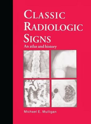 Classic Radiologic Signs: An Atlas and History by Mulligan, M. E.