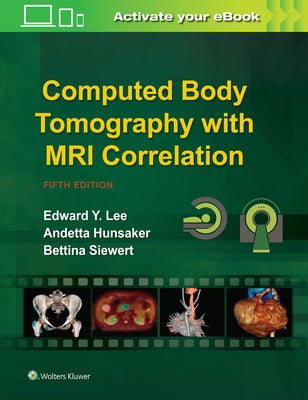 Computed Body Tomography with MRI Correlation by Lee, Edward Y.