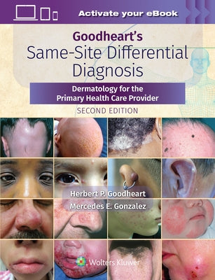Goodheart's Same-Site Differential Diagnosis: Dermatology for the Primary Health Care Provider by Goodheart, Herbert