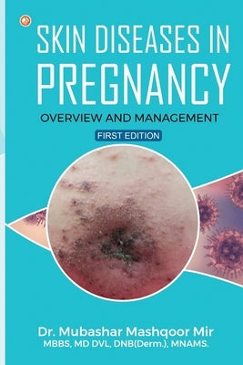 Skin Diseases in Pregnancy: Overview and Management by , Dnb Mnams