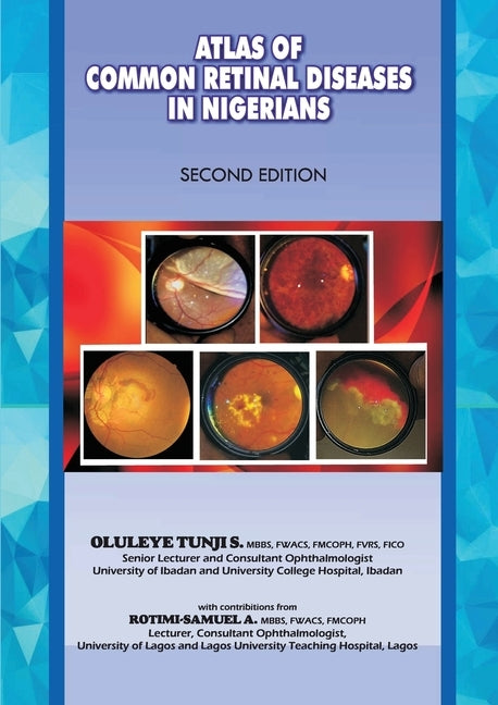 The Atlas of Retinal Diseases in Nigerians by Tunji, Oluleye S.