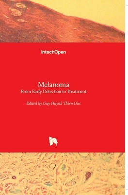 Melanoma: From Early Detection to Treatment by Duc, Guy Huynh Thien