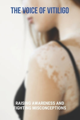 The Voice Of Vitiligo: Raising Awareness And Fighting Misconceptions: Tips On Finding Your Purpose In Life by Terrebonne, Sharyn