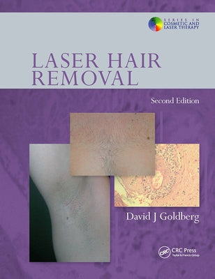 Laser Hair Removal by Goldberg, David J.