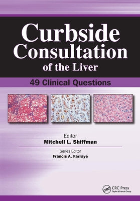 Curbside Consultation of the Liver: 49 Clinical Questions by Shiffman, Mitchell