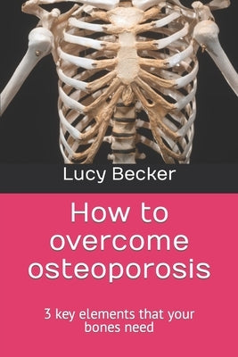How to overcome osteoporosis: 3 key elements that your bones need by Becker, Lucy