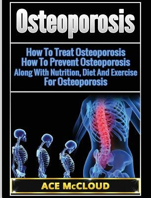 Osteoporosis: How To Treat Osteoporosis: How To Prevent Osteoporosis: Along With Nutrition, Diet And Exercise For Osteoporosis by McCloud, Ace