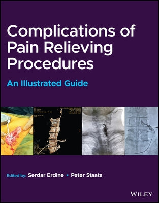 Complications of Pain-Relieving Procedures: An Illustrated Guide by Erdine, Serdar