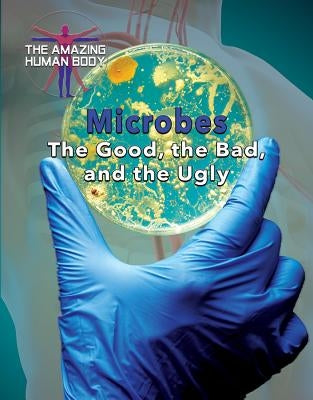 Microbes: The Good, the Bad, and the Ugly by Randolph, Joanne