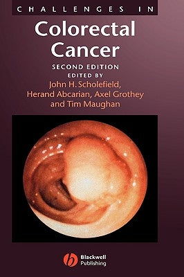Challenges in Colorectal Cancer by Scholefield, John H.
