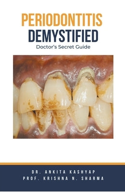 Periodontitis Demystified: Doctor's Secret Guide by Kashyap, Ankita