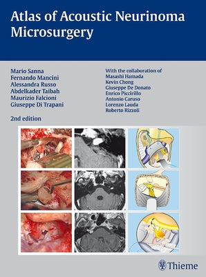 Atlas of Acoustic Neurinoma Microsurgery by Sanna, Mario