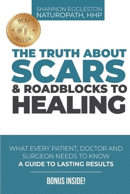 The Truth About Scars and Roadblocks to Healing: What Every Patient, Doctor, and Surgeon Needs to Know by Eggleston, Shannon
