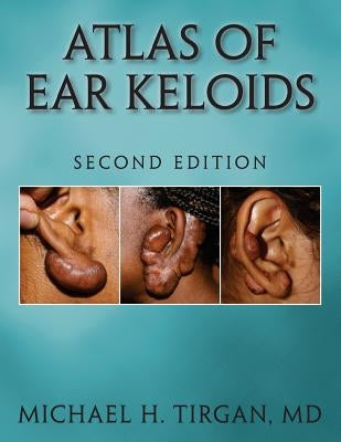 Atlas of Ear Keloids - Second Edition by Tirgan MD, Michael H.