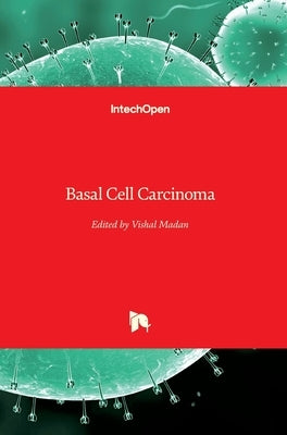 Basal Cell Carcinoma by Madan, Vishal