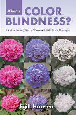 What is Color Blindness?: What to Know if You're Diagnosed With Color Blindness by Hansen, Egill