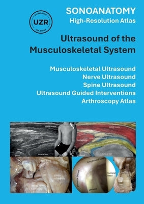 Sonoanatomy - High-Resolution Atlas - Ultrasound of the Musculoskeletal System: Musculoskeletal Ultrasound, Nerve Ultrasound, Spine Ultrasound, Ultras by Tamborrini, Giorgio