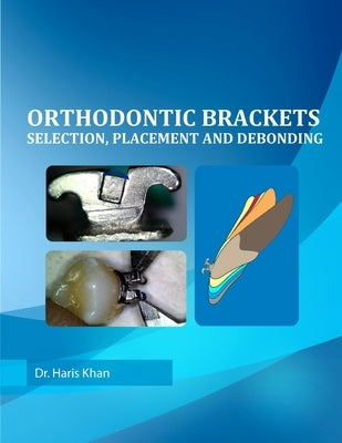Orthodontic Brackets: Selection, Placement and Debonding by Khan, Haris