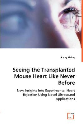 Seeing the Transplanted Mouse Heart Like Never Before by Bishay, Ramy