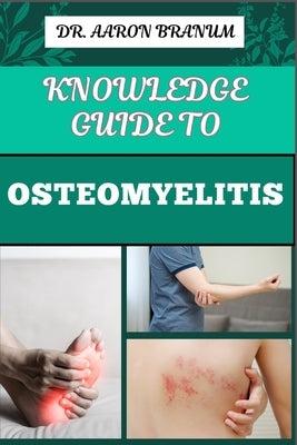 Knowledge Guide to Osteomyelitis: Essential Manual To Diagnosis, Treatment, Prevention, and Advanced Therapies for Bone Infection Management by Branum, Aaron