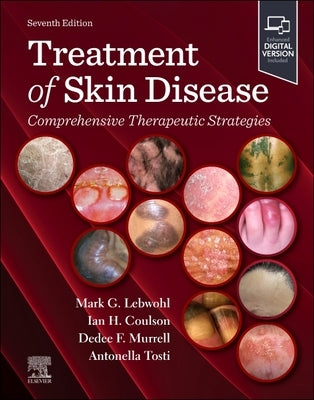 Treatment of Skin Disease: Comprehensive Therapeutic Strategies: Comprehensive Therapeutic Strategies by Lebwohl, Mark