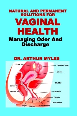 Natural and Permanent Solutions for Vaginal Health: Managing Odor And Discharge by Myles, Arthur