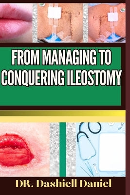 From Managing to Conquering Ileostomy: Expert Guide To Understanding the Causes, Recognizing Symptoms, Prevention and Embracing Effective Treatments f by Daniel, Dashiell