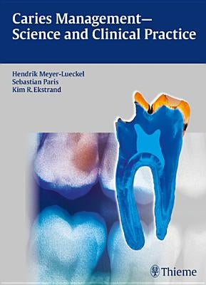 Caries Management - Science and Clinical Practice by Meyer-Lückel, Hendrik