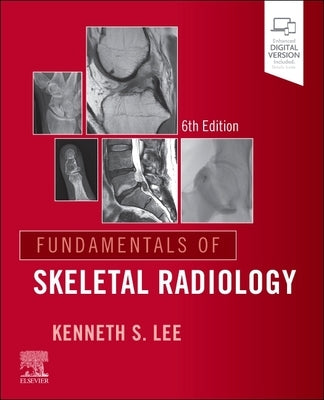 Fundamentals of Skeletal Radiology by Lee, Kenneth S.