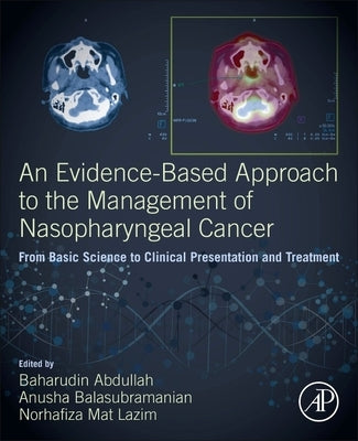 An Evidence-Based Approach to the Management of Nasopharyngeal Cancer: From Basic Science to Clinical Presentation and Treatment by Abdullah, Baharudin