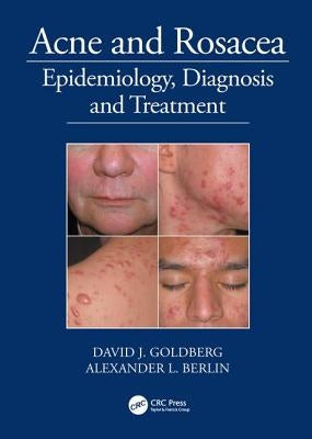 Acne and Rosacea: Epidemiology, Diagnosis and Treatment by Goldberg, David