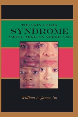 The Skin Color Syndrome Among African-Americans by James, William A., Sr.