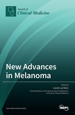 New Advances in Melanoma by Larrib`ere, Lionel