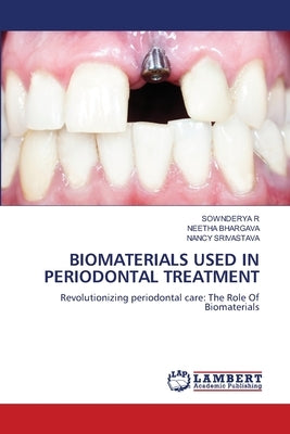 Biomaterials Used in Periodontal Treatment by R, Sownderya