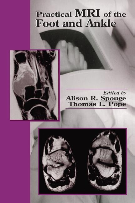 Practical MRI of the Foot and Ankle by Spouge, Alison R.