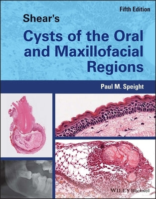 Shear's Cysts of the Oral and Maxillofacial Regions by Speight, Paul M.