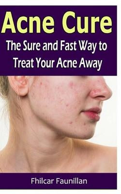 Acne Cure: The Sure and Fast Way to Treat Your Acne Away by Faunillan, Fhilcar