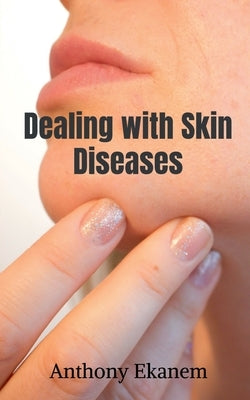Dealing with Skin Diseases by Ekanem, Anthony