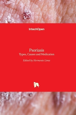 Psoriasis: Types, Causes and Medication by Lima, Hermenio